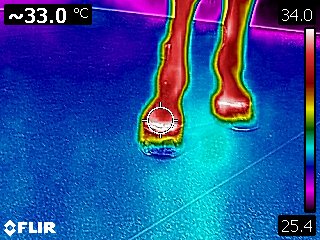 Termografía de la mano afectada antes del tratamiento: lectura de 33,0 °C en el casco